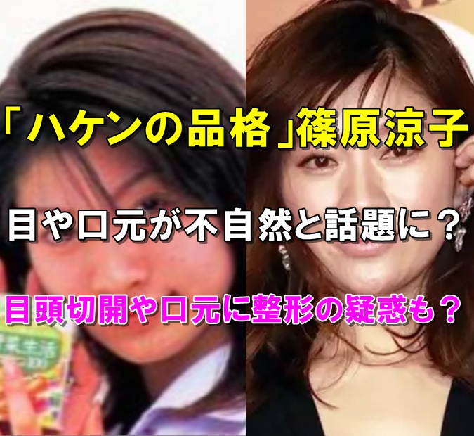比較画像、篠原涼子は口元が不自然で目頭切開と噂？