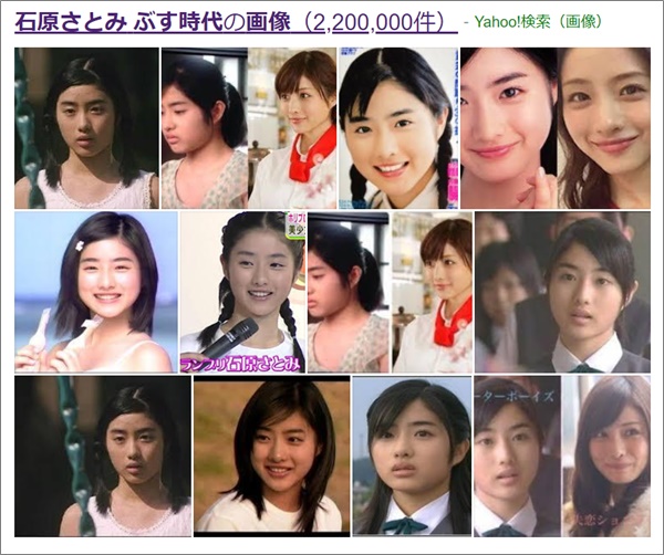 衝撃 石原さとみぶす時代の画像がヤバい 顔でかい頃と現在を比較 R40 Headline