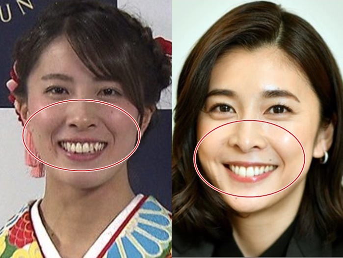 比較画像 大橋悠依がかわいい 竹内結子に似てる 口元や鼻がそっくりと噂